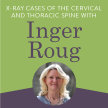 X-ray Cases of the Cervical and Thoracic Spine with Inger Roug image