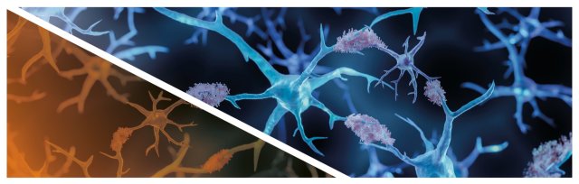 Michel Goedert: Understanding neurodegenerative diseases