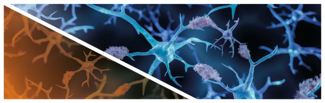 Michel Goedert: Understanding neurodegenerative diseases